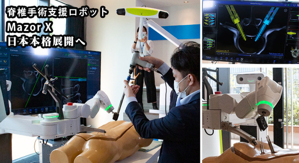 【速報】脊椎固定術の手術支援ロボットシステム「Mazor X」のしくみと特徴を日本メドトロニックが公開