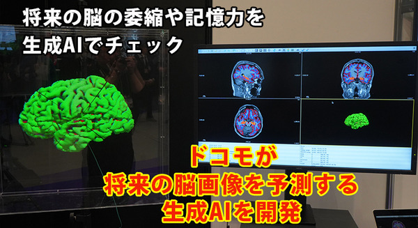 「5年後、認知機能に影響する脳の海馬はどれだけ萎縮する?」ドコモが将来の脳画像を予測する生成AIを開発 海馬の体積変化を可視化