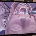 MR技術を医療に応用 世界初の歯科治療MRシミュレーションシステムの意義としくみ