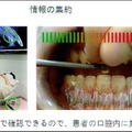MR技術を医療に応用 世界初の歯科治療MRシミュレーションシステムの意義としくみ