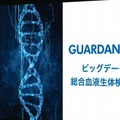 孫正義氏「超知性を持つロボットの誕生」ARM、衛星通信、癌発見　ソフトバンクグループ株主総会