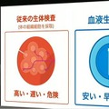 孫正義氏「超知性を持つロボットの誕生」ARM、衛星通信、癌発見　ソフトバンクグループ株主総会