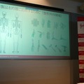 ジョンソン・エンド・ジョンソン、整形外科関連製品を扱うロボット倉庫を公開　ノルウェー製「オートストア」を導入