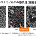 【速報】広島大学病院「紫外線Care222は新型コロナウイルスの不活化に有効」世界に先駆けて発表　ウシオ電機の製品で実証