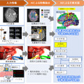 【国内初】5Gとクラウドで大容量の手術データをAIが解析する実証実験へ ドコモ(5G)、はこだて未来大(AI)、東京女子医科大(SCOT)