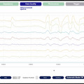 マクニカが脳波を活用する技術「BrainTech」を発表　InnerEye社のソリューションを販売へ　AIの機械学習を高速化、社会実装を加速