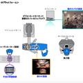 手術支援ロボット「ダビンチ」手術中の映像を遠隔で視聴できる認定医向け「リモート症例見学プログラム」の運用開始