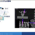 【速報】脊椎固定術の手術支援ロボットシステム「Mazor X」のしくみと特徴を日本メドトロニックが公開
