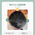 スマホで撮影して赤ちゃんの頭のゆがみ度をAIが測定・可視化する「頭のかたちAI測定」をリリース