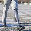 パワード義足「Bio Leg」が米国で医療保険適用承認を取得　モーター駆動で階段の昇降や立ち上がりもスムーズにアシスト