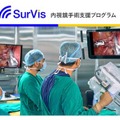 NVIDIAのGPU搭載「内視鏡手術支援プログラムSurVis-Hys」が医療機器承認を取得　Jmeesと国立がん研究センター東病院が共同開発