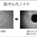 ソフトバンクと東京大、脳オルガノイドで「人工脳細胞のプロセッサ」を共同研究、世界初の成果を発表 「脳細胞が次世代コンピュータになる」