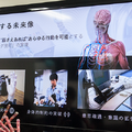 サイボーグ技術が社会にもたらす「3つの変化」とは　メルティン CEO インタビュー(2/2)