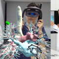 日本メドトロニックやキヤノンら、CT検査画像を立体視で観察するMRトレーニングシステムを開発　肺の立体的な構造理解を促進「MR Anatomy」